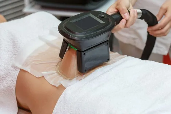 Image of person having fat freezing treatment to help weight gain Aberdeen