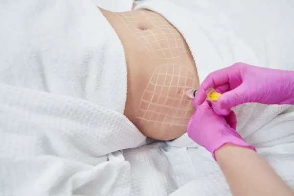 image of fat dissolving injections on love handles to help combat weight gain Aberdeen