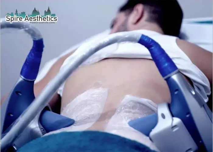 Man having fat freezing treatment done on love handles before a competitions Aberdeen to create a sculpted look.
