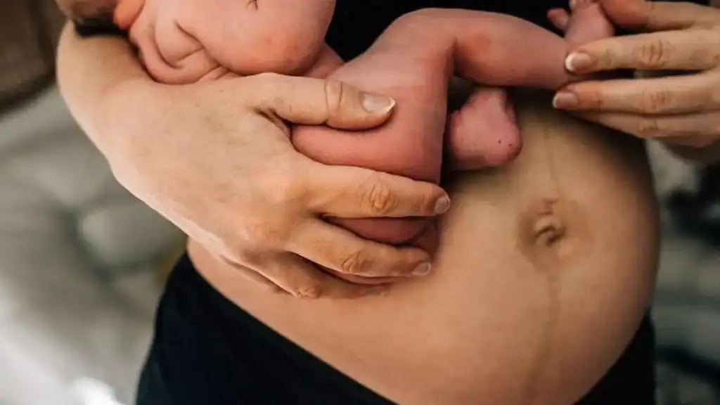 Why Is My Stomach Still Big After Pregnancy Aberdeen?